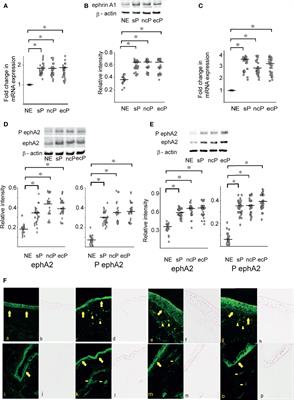 Frontiers | The Expression of ephrinA1/ephA2 Receptor Increases in 